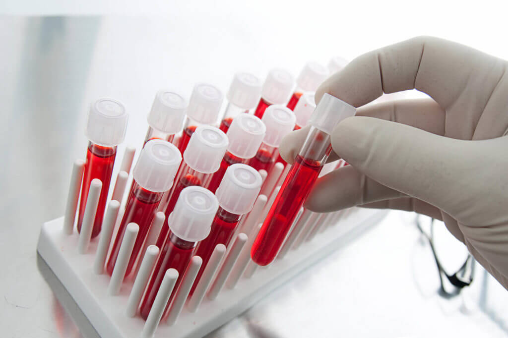 Підтверджено ефективність тесту на рак за аналізом крові