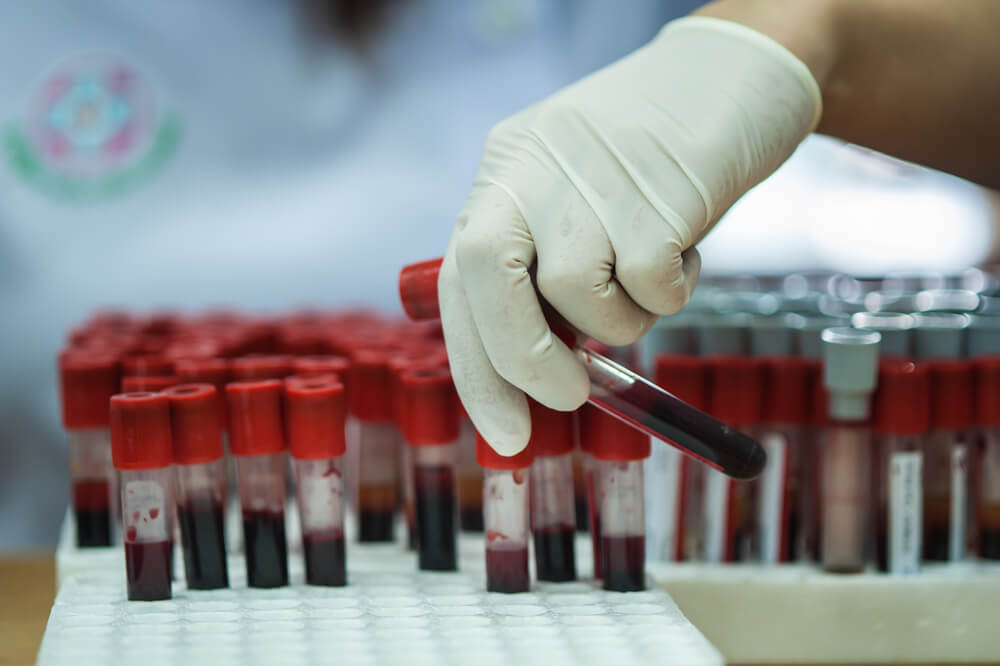 Від небезпеки коронавірусу захистить… група крові