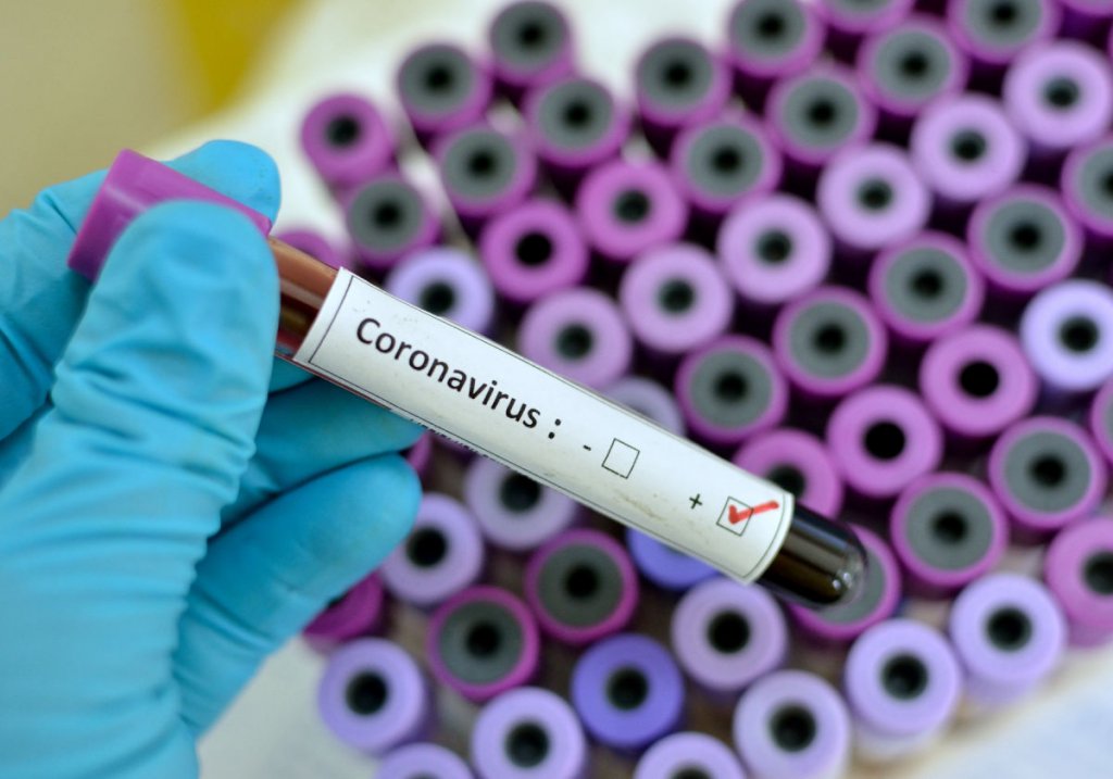 Тести на коронавірус в Україні