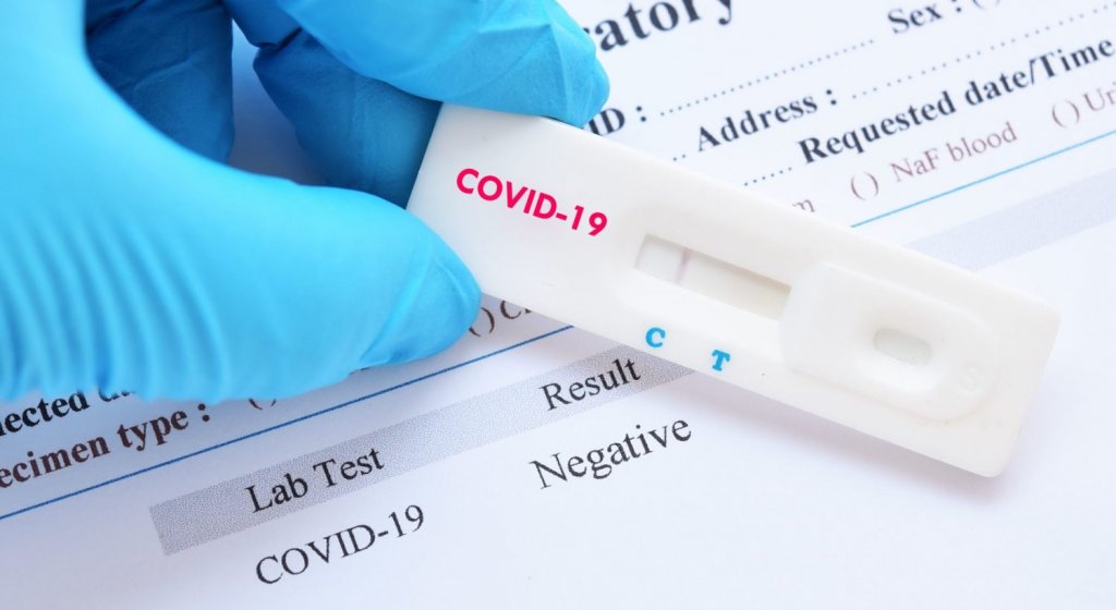 Кого ы як тестуватимуть на COVID-19? Пояснює МОЗ