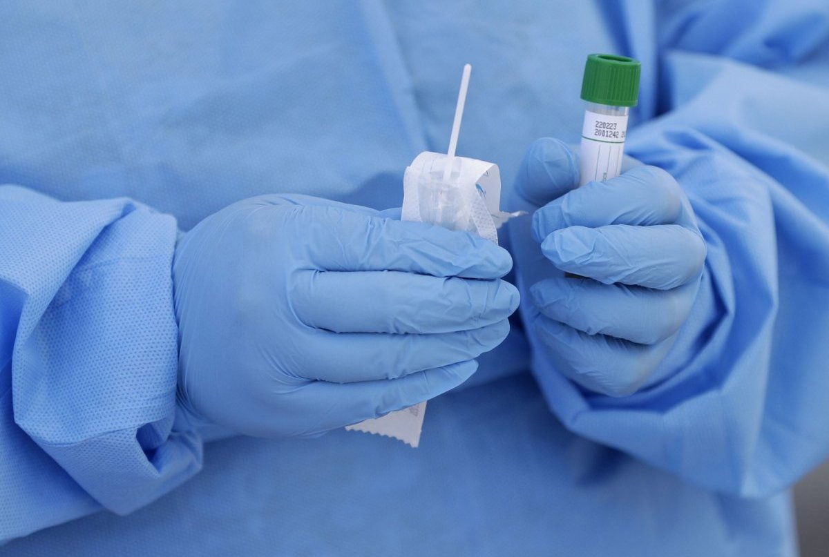 Близько 20 осіб повторно інфікувалися коронавірусом на Буковині