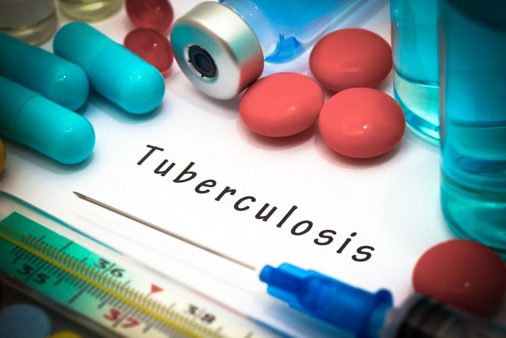 Генералізована форма туберкульозу