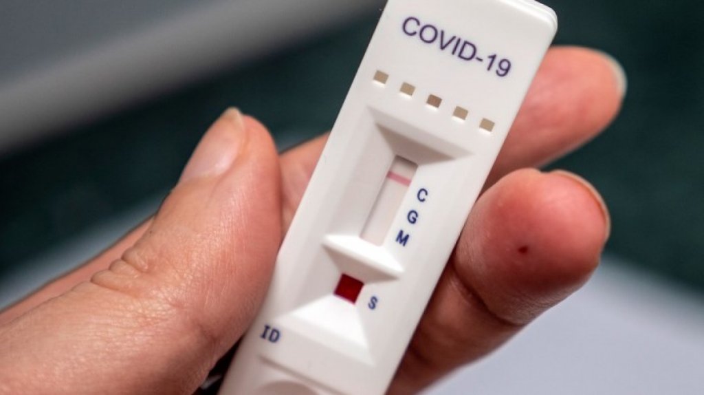 Уряд та Верховна Рада погодили закупівлю ще 6 млн експрес-тестів на COVID-19