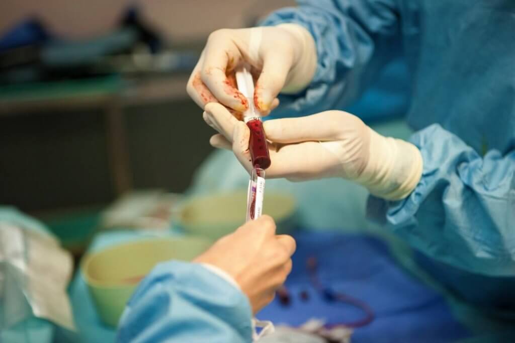 В Україні у 2021 році збільшать тариф на алотрансплантацію
